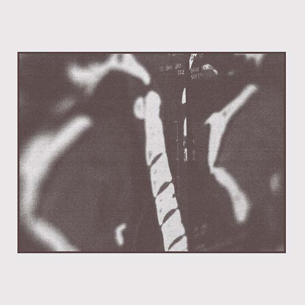 MRI |