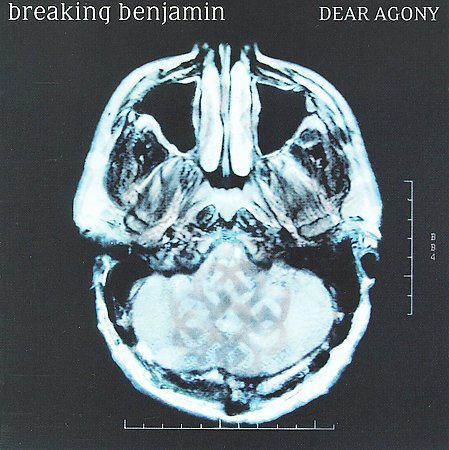 Dear Agony |