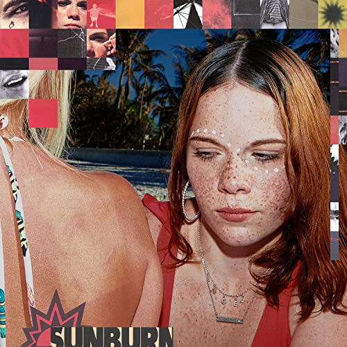 Sunburn |