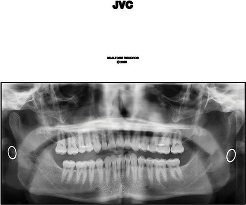 JACK VAN CLEAF - JVC (VINYL 2xLP) | NEW Mint (M) Mint (M) - FOLK *NEW*