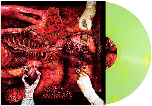 (PRESALE 6/12/26) Manual Manic Procedures (GREEN YELLOW VINYL) | Mint (M) Mint (M) - METAL *NEW/COLOR*