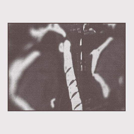MRI |